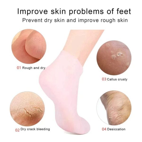 Moisturizing Gel Socks – Heel Crack Repair & Relief