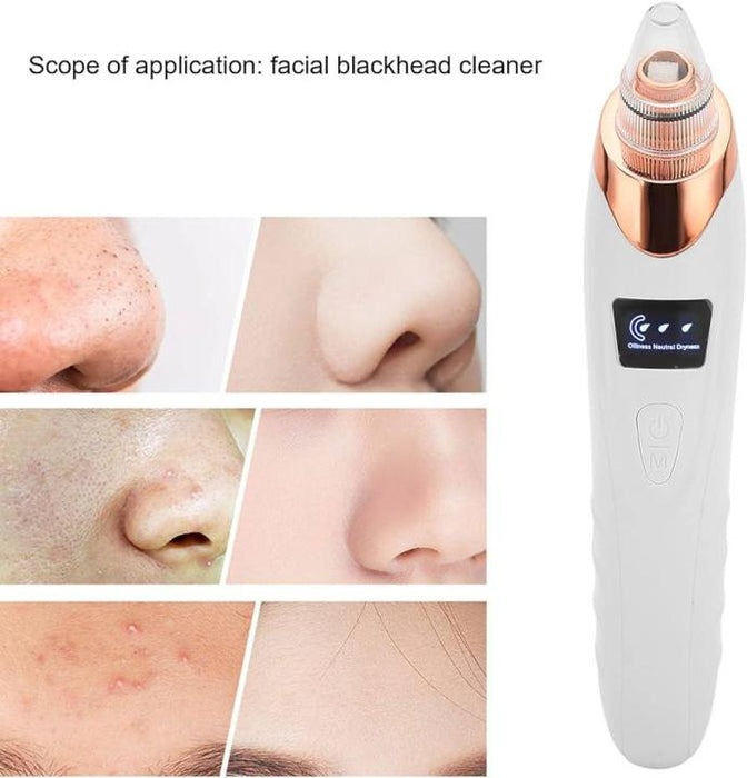 Face Vacuum Blackhead Remover Pore Cleaner | Electric Deep Cleansing Tool For Nose & Face
