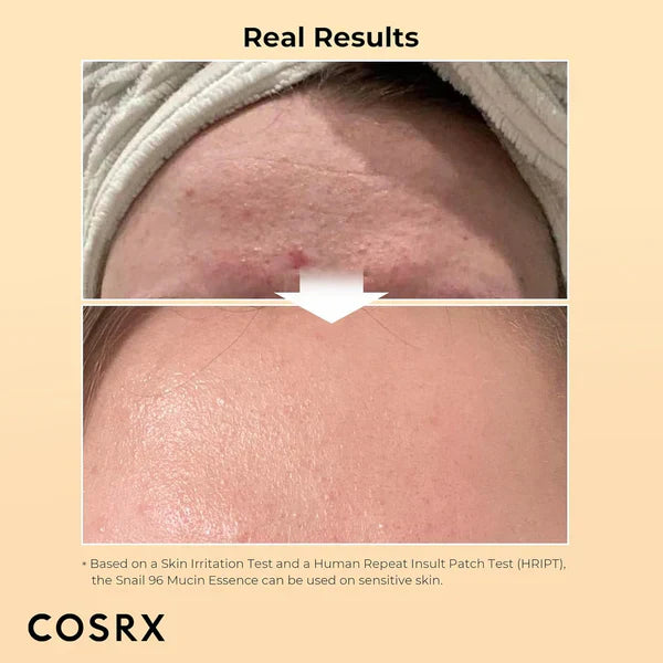 COSRX Snail 96 Mucin Essence (100ml)