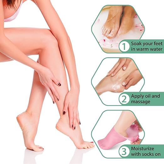 Moisturizing Gel Socks – Heel Crack Repair & Relief
