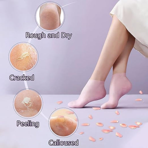 Moisturizing Gel Socks – Heel Crack Repair & Relief