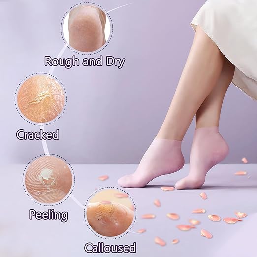 Moisturizing Gel Socks – Heel Crack Repair & Relief