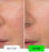 Dermive Oil-Free Moisturizer – Ultimate Skin Hydration | Best Oil-Free Formula for Healthy Glow